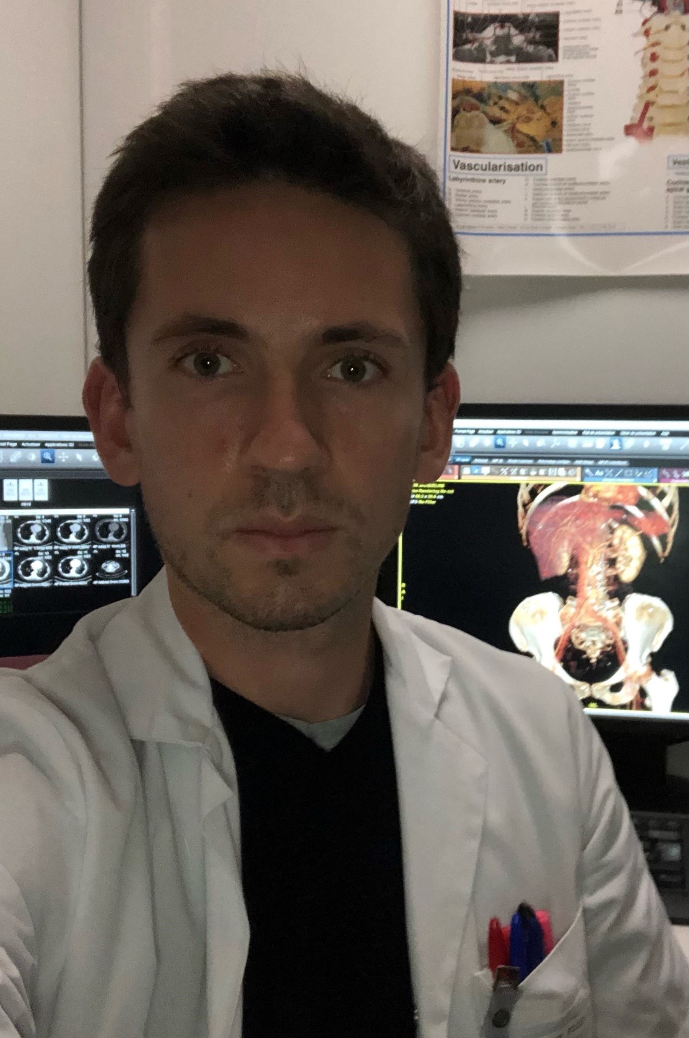 LE FLOCH PIERRE-YVES