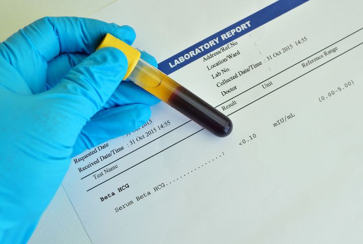 Beta hcg : image d'une fiole contenant une analyse sanguine pour un test BHCG