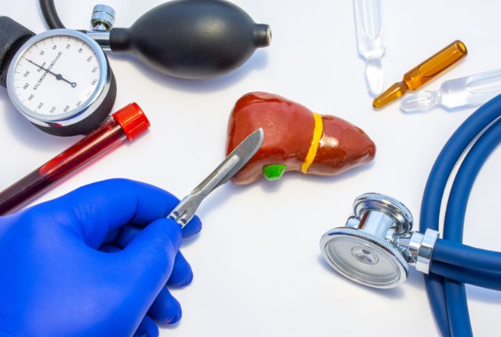 Hepatectomie : image d'une medecin tenant un scalpel, pret a operer le foie