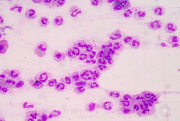 Pneumocoque : image d'un bactérie pneumocoque au microscope