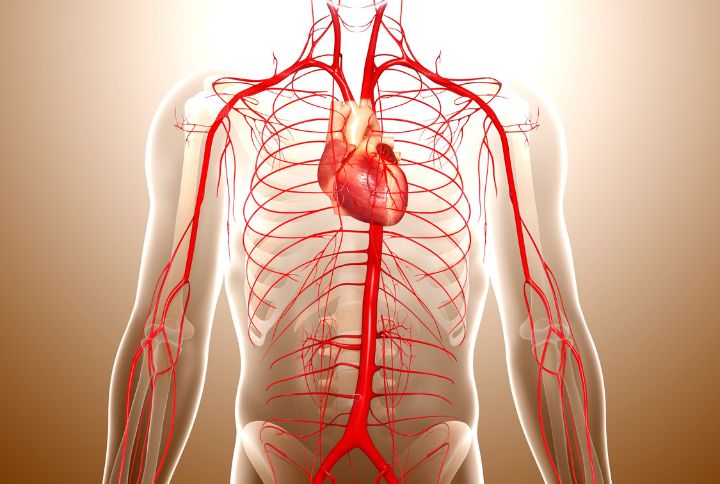 Anévrisme de l'aorte abdominale. Image d'un tronc parcouru par l'aorte depuis le cœur jusqu'au bas du ventre où elle se scinde en deux pour irriguer les jambes. 