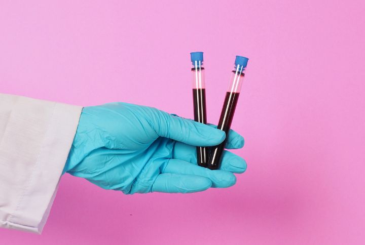 Sept différences entre cholestérol et triglycérides. Image d'une main gantée tenant deux tube remplis de sang prêts à être analysés.