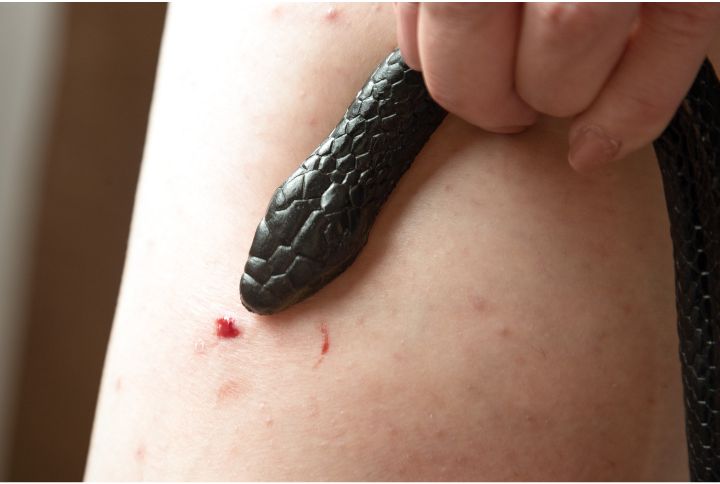 Comment réagir face à une morsure de serpent ? Serpent plaqué fermement sur une jambe après une piqûre (ne jamais essayer de faire ceci).