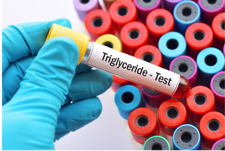 Triglycérides, de quoi parle-t-on ? Image d'un tube pour le recueil du sang dans le but d'une analyse.